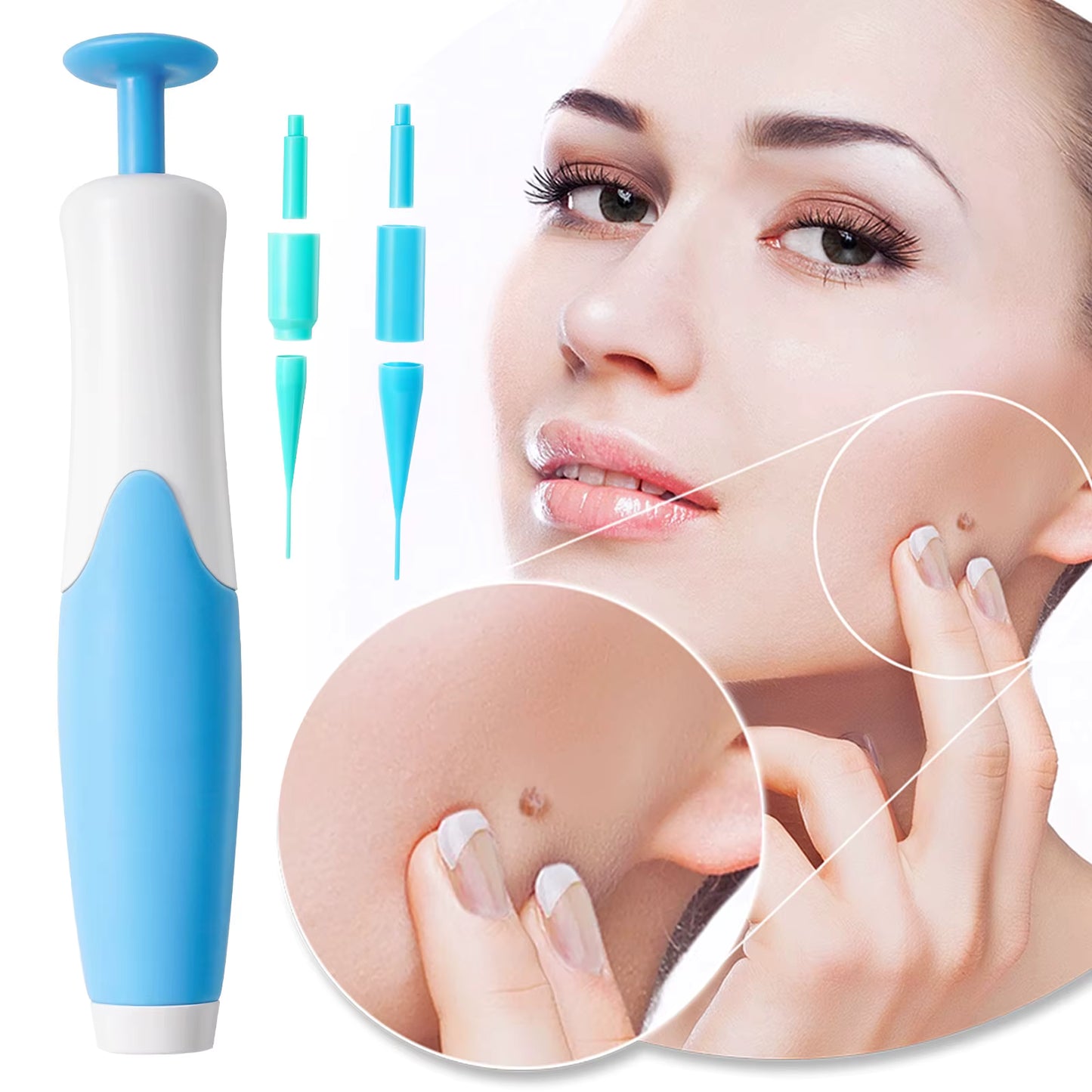 Removedor de Verrugas e Skin Tags SkinClear™