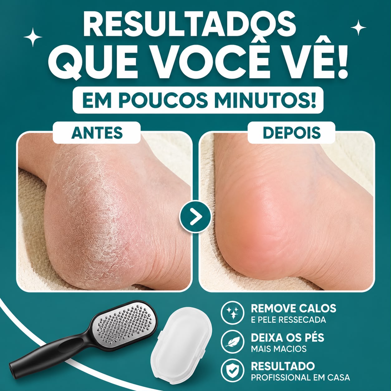 Lixa Removedora de Calos